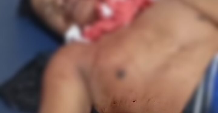 Perkelahian Berdarah Awal Tahun terjadi di Lombok Timur bagian Selatan