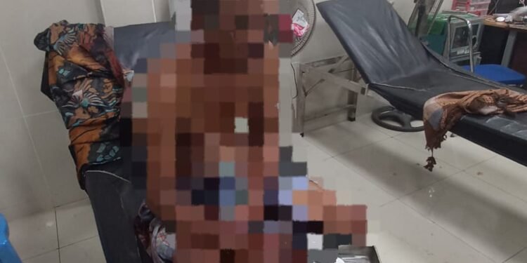 Komplotan Maling Ternak Saling Serang dengan Warga, Satu Pelaku Luka Parah dan Diamankan Polsek Mandalika