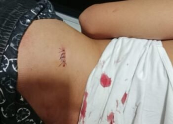 Ditebas Sesama Teman SMAN Labuhan Haji,  Pelajar Lotim Dilarikan ke Puskesmas